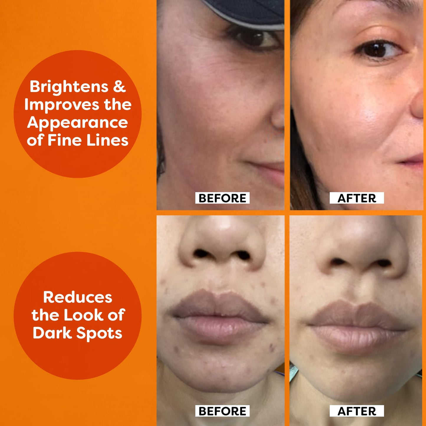 TruSkin Vitamin C Serum For Face – Anti Aging Formula with Vitamin C, Hyaluronic Acid, Vitamin E – Brightening Serum – Improve Appearance of Dark Spots, Tone, Fine Lines & Wrinkles, 2 Fl Oz